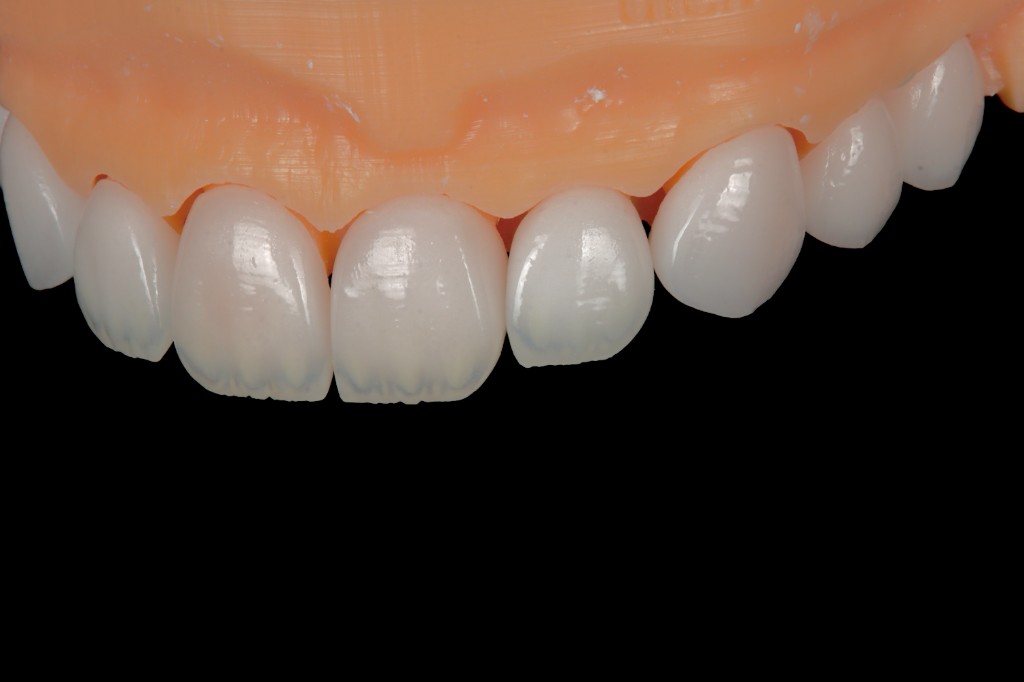 Charecterized incisal edge translucency detail