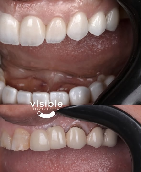 Visible Clinic restorative before and after